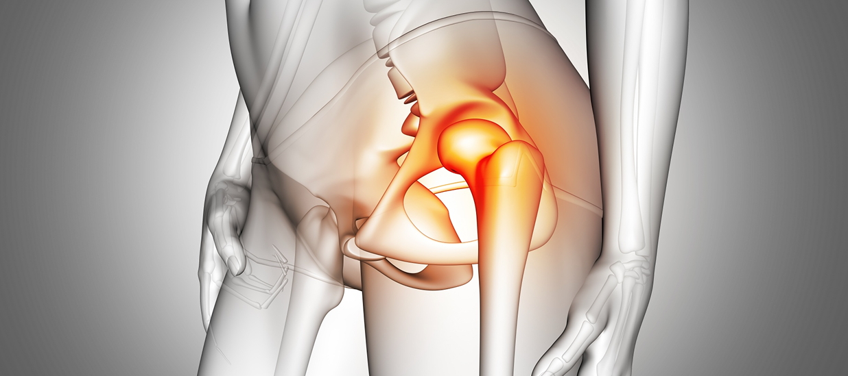 hip replacement surgery in Dubai