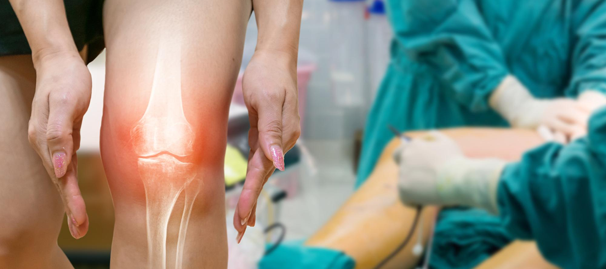 knee replacement surgery in Dubai