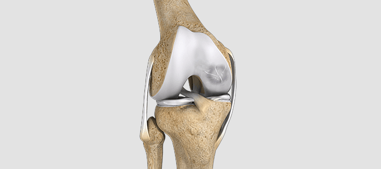 Osteochondritis dissecans of knee