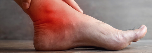 Tarsal tunnel Syndrome