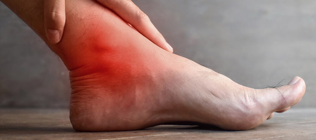 tarsal tunnel syndrome treatment in Dubai