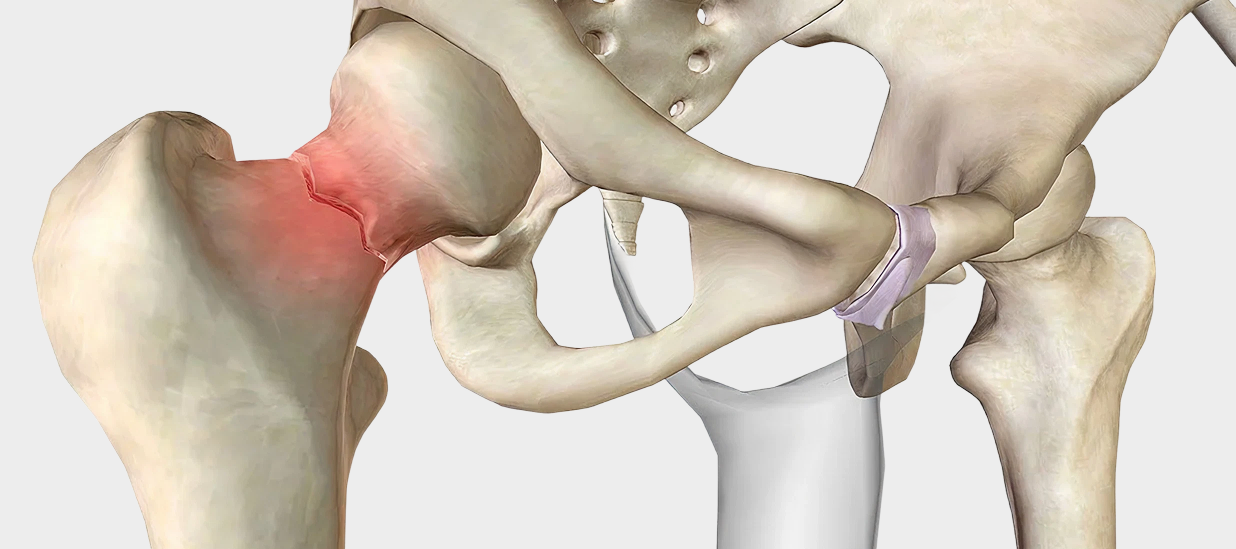 orthopedic trauma surgery in Dubai