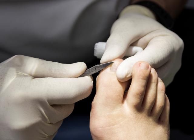 age related foot problems nails