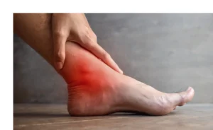 Ankle Sprain Grades